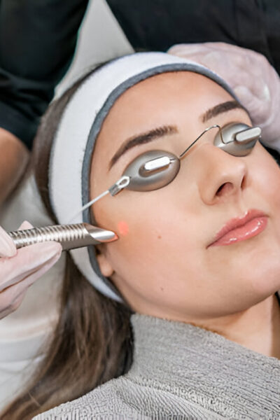 Er:YAG laser